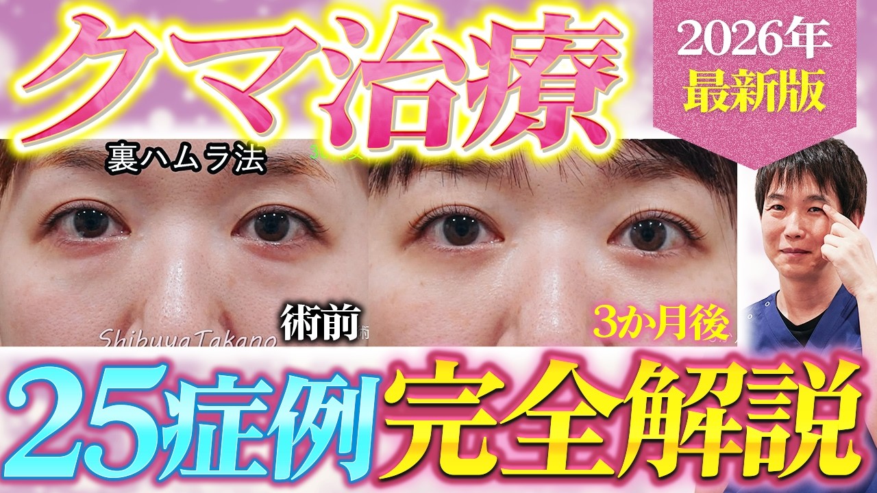 【50-60代必見】失敗しないための、目の下のクマ取りのすべてを解説【クマ取り / ハムラ法 / 裏ハムラ / 表ハムラ / 脂肪注入 / アンチエイジング】