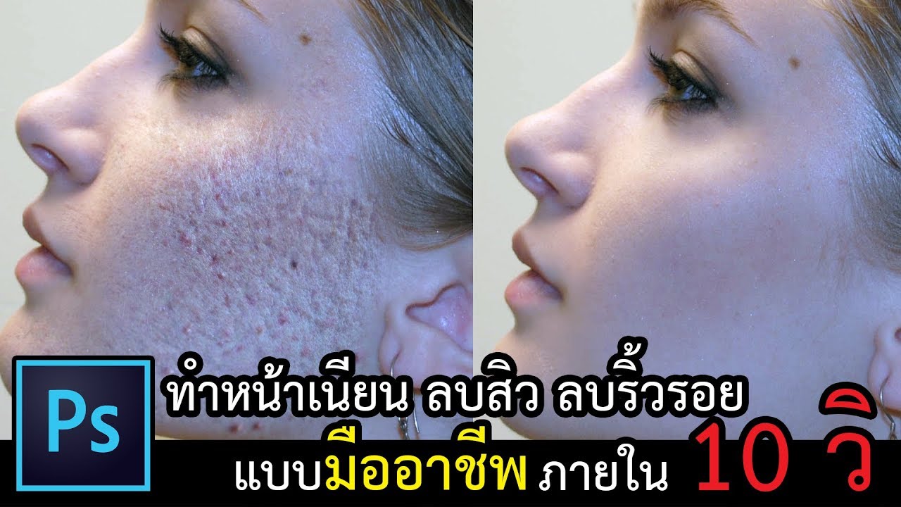สอน Photoshop แต่งผิวเรียบเนียน รีทัช ลบรอยสิว แบบมืออาชีพ ภายใน 10วินาที