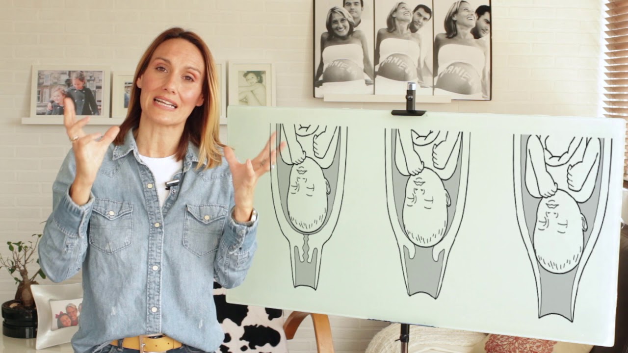 29.-Resumen Parto| Arancha Matrona