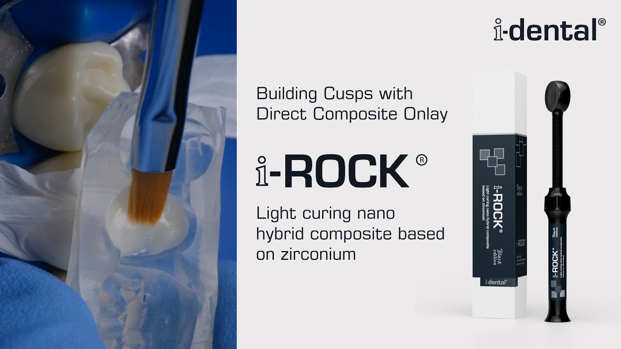 i-ROCK  |  LC Nano Hybrid Composite Based On Zirconium | Building Cusps with Direct Composite Onlay