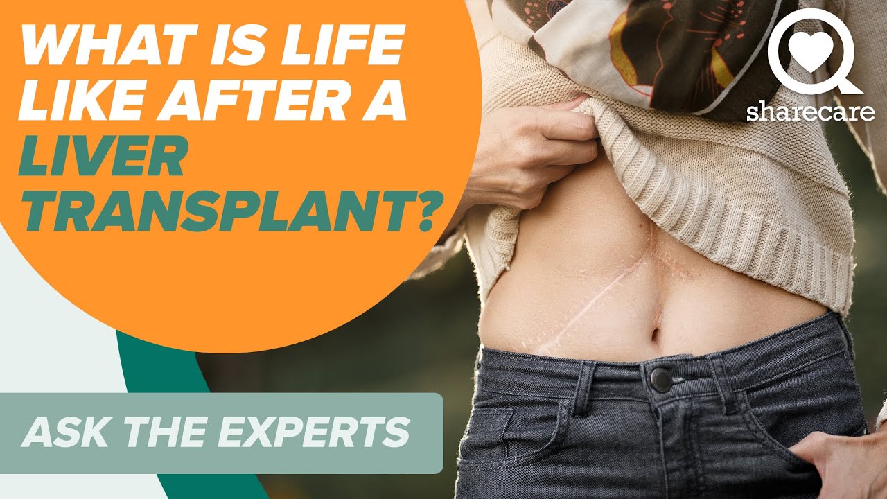 What is Life Like After A Liver Transplant? | Ask The Experts | Sharecare