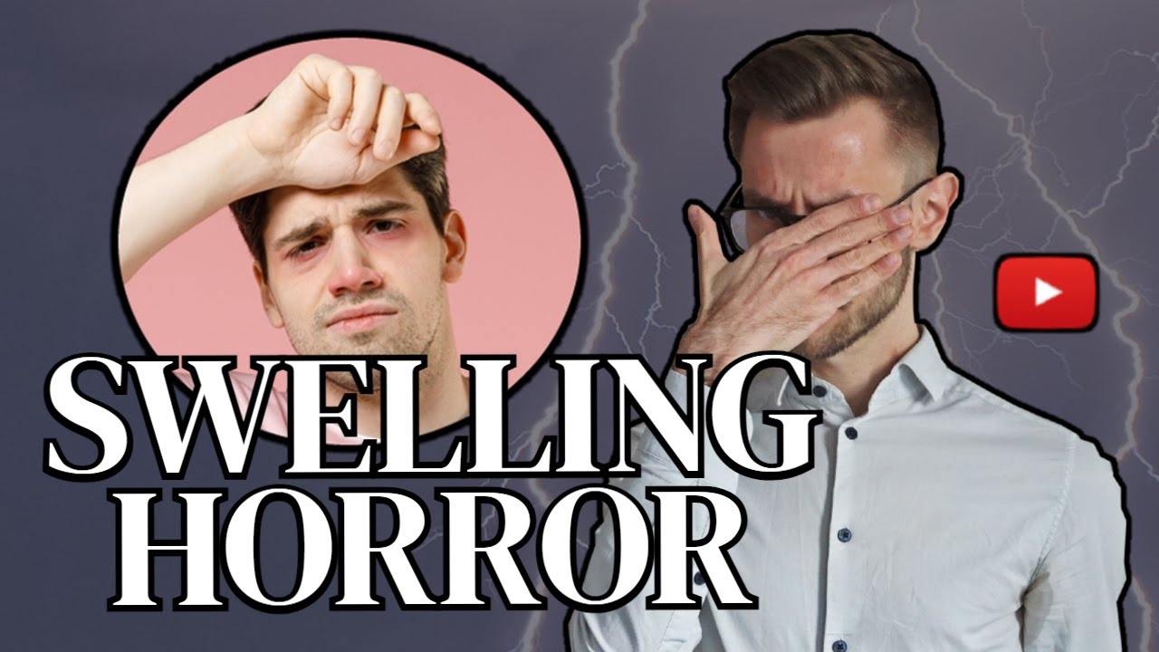 How to Handle Swelling After Hair Transplant: Expert Tips and Tricks Revealed!