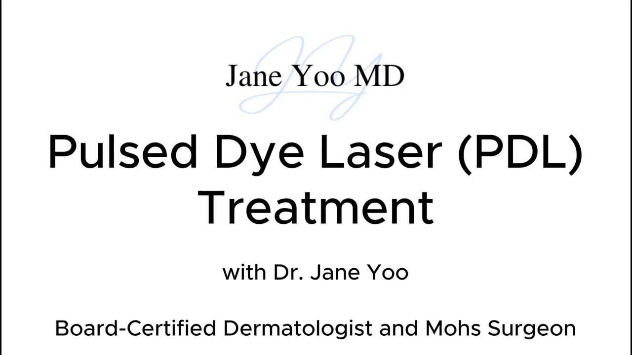 Pulsed Dye Laser (PDL) Treatment