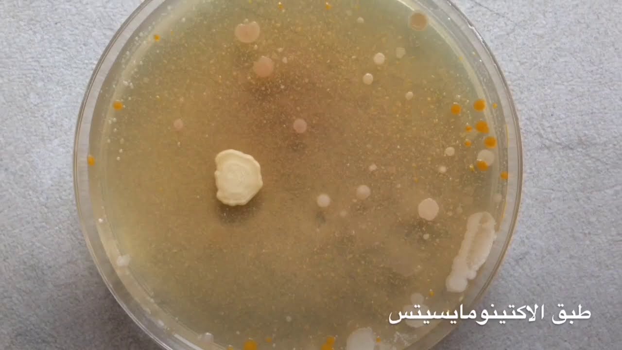 تقدير البكتريا والفطريات في التربة بطريقة التخافيف والعد بالاطباق