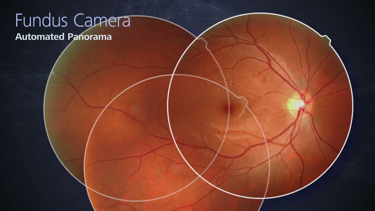 NIDEK RETINA SCAN DUO™ 2