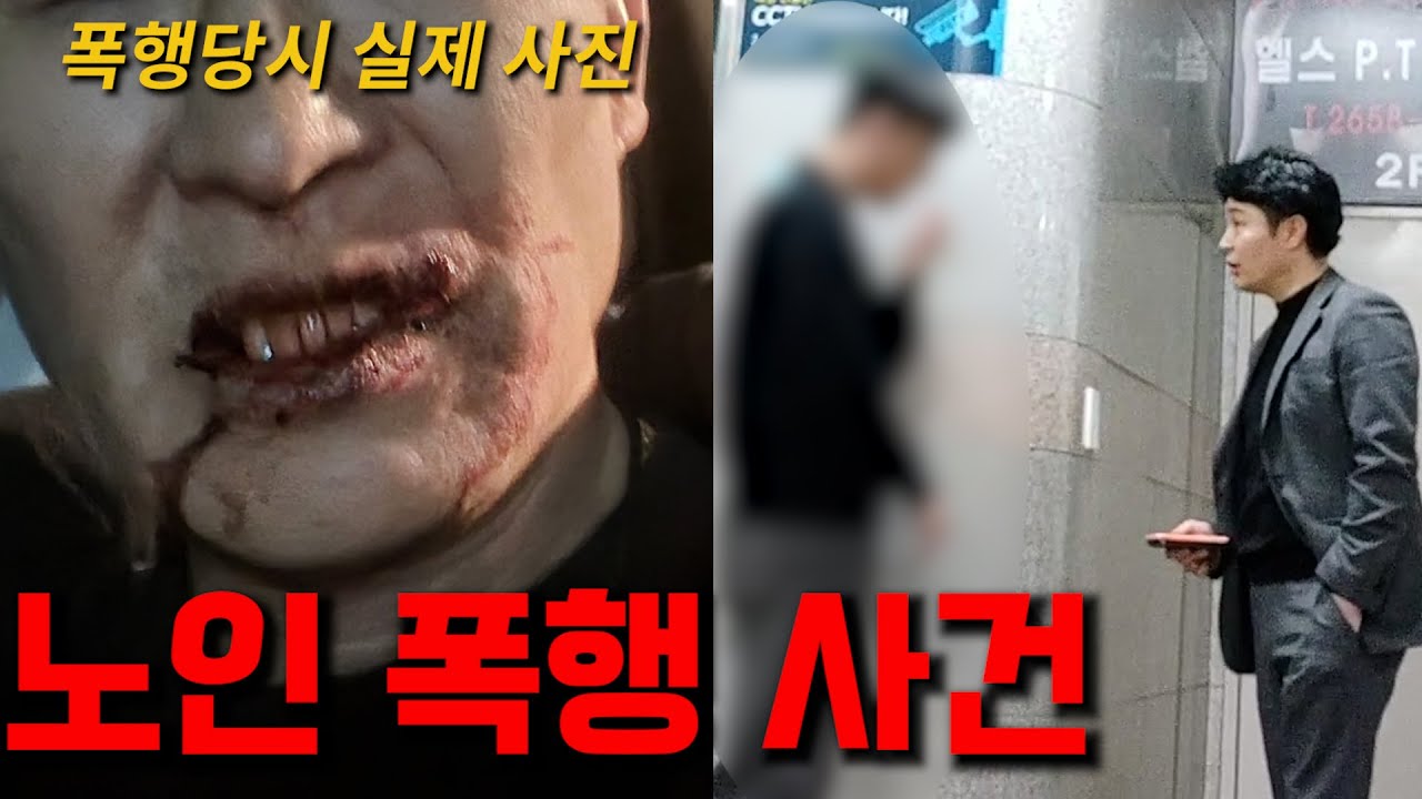 허위매물 폭행사건!! 쓰러진 노인을 잔인하게 짓밟아버린 허위딜러! 실제상황입니다