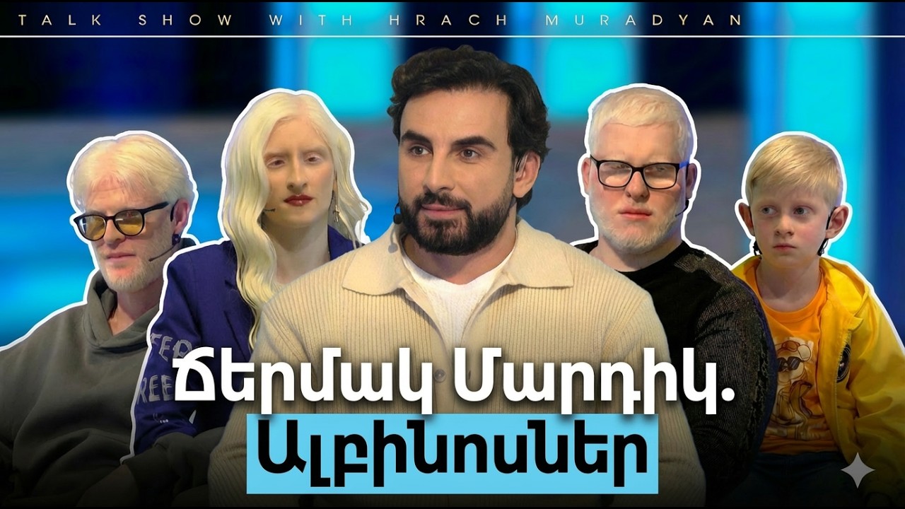 Ճերմակ Մարդիկ. Ալբինոսներ / Բաց Թեմա