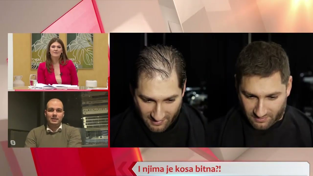 E UŽIVO: Nadogradnja kose - Bojan Marović