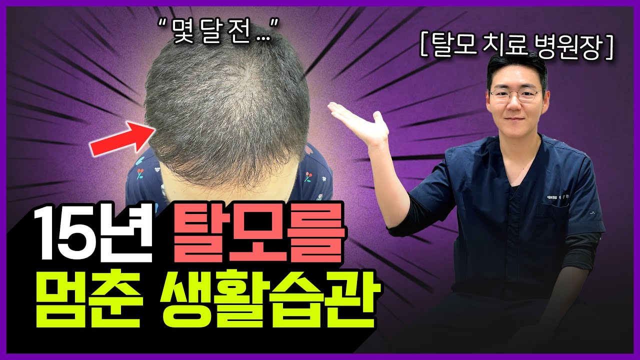 수술없이 탈모 극복한 후기