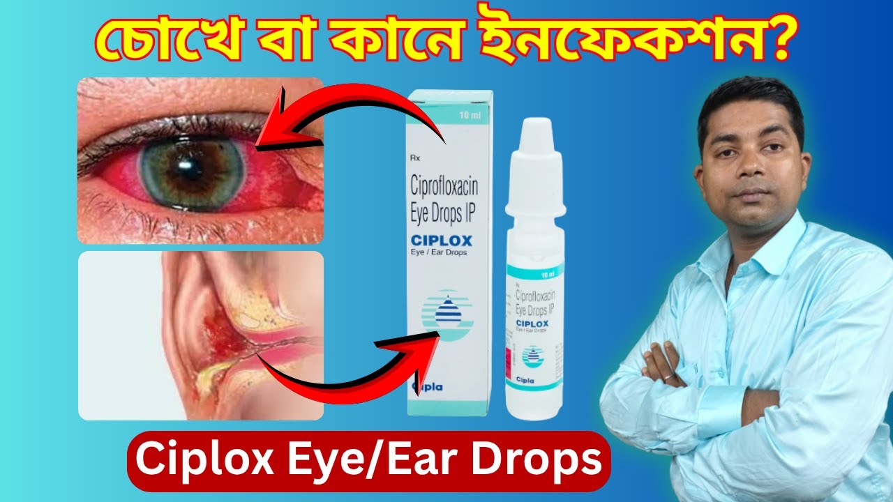 Ciplox Eye/Ear Drops Uses in Bengali | ciplox eye drops | Ciplox Drops