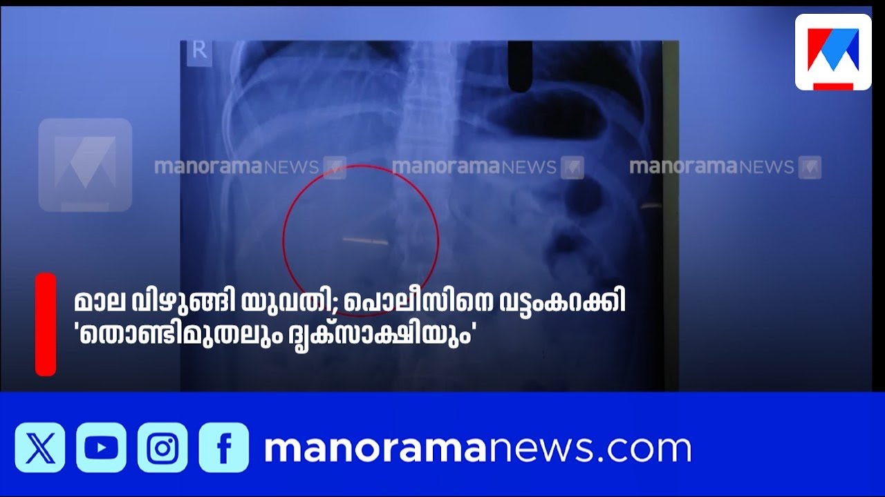 മാല വിഴുങ്ങി യുവതി; തൊണ്ടിമുതൽ വീണ്ടെടുക്കാൻ പാടുപെട്ട് പൊലീസ് |Malappuram News|Nilambur