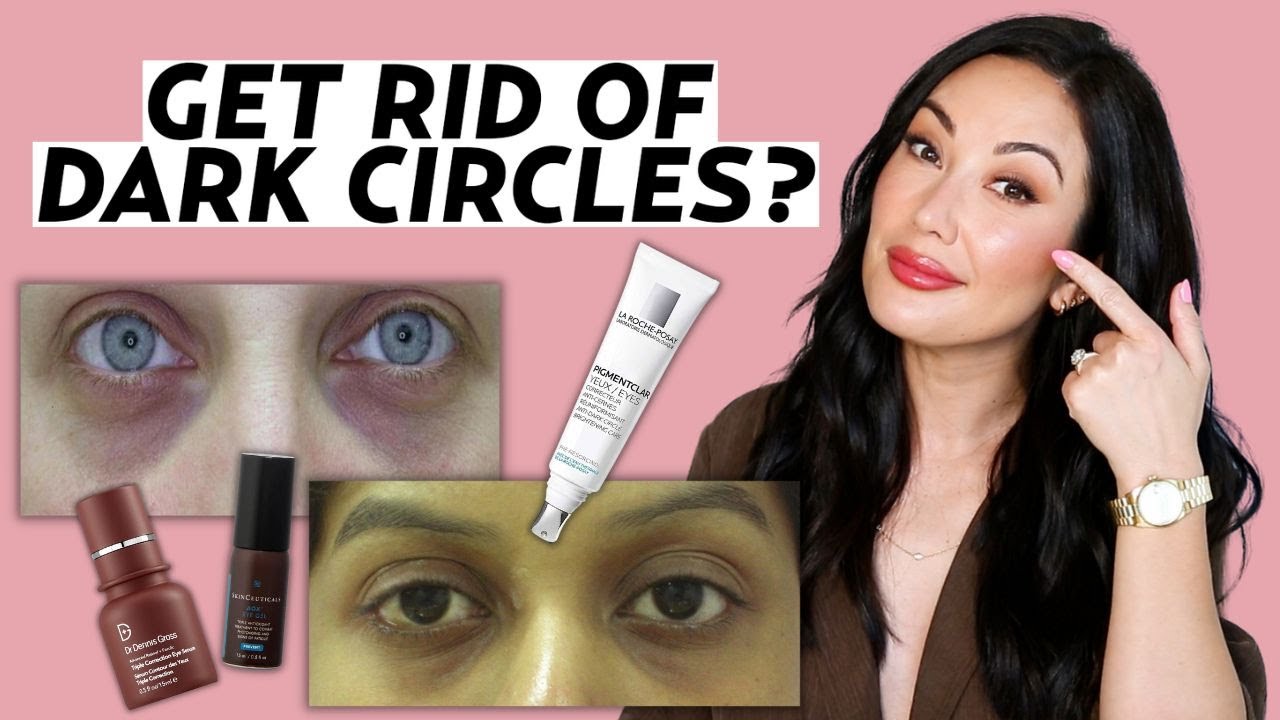 Expert Tips to Get Rid of Dark Circles! (Skincare & Treatment Recommendations)