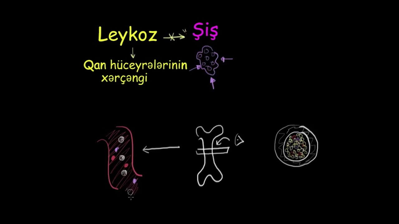 Leykoz nədir? | Hematoloji sistem xəstəlikləri