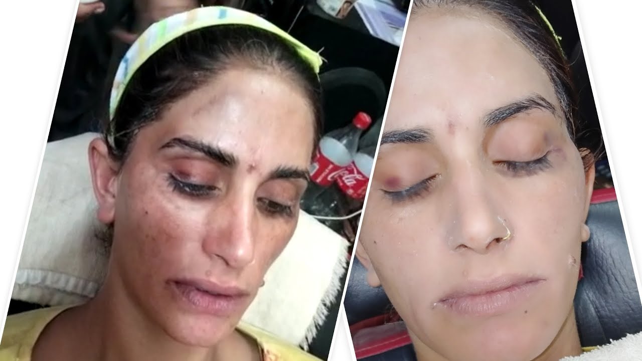 Gold polish with Gold facial/by shagufta