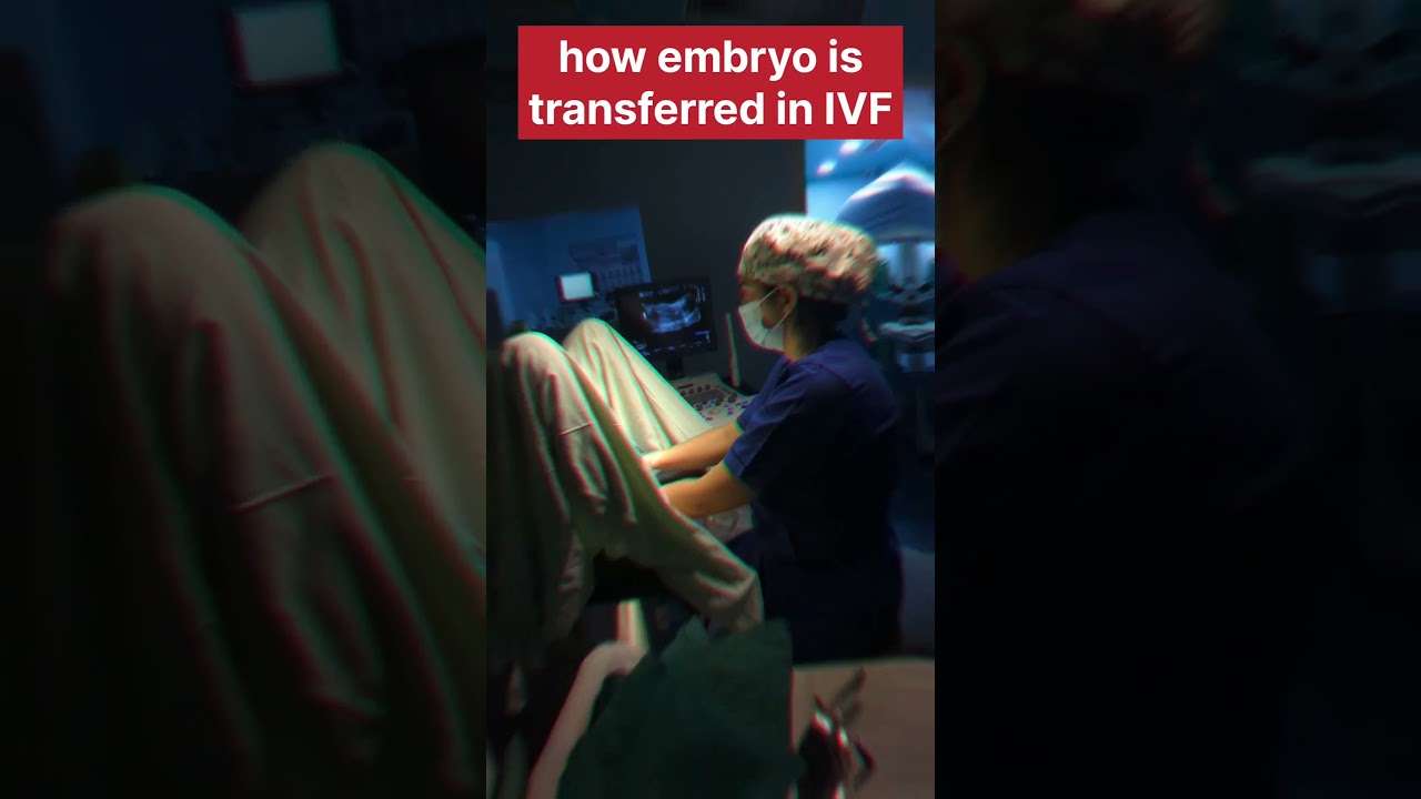 How embryo is transferred in IVF #doctorlife #doctor #ivfdoctor #mbbs #medicaldoctor #ivf #medical