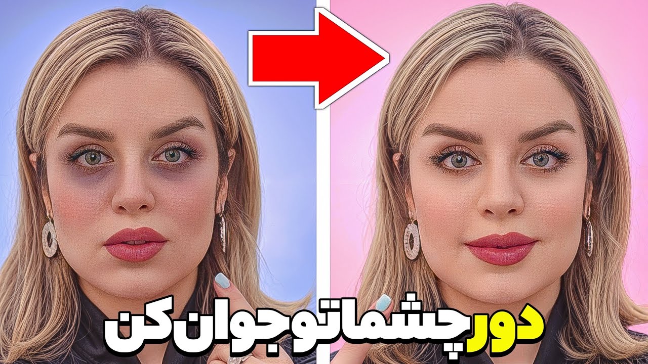 باور نمی‌کنی این روش پف و تیرگی زیر چشم رو محو می‌کنه! | راهکار رفع چروک و تیرگی دورچشم بااثرعالی