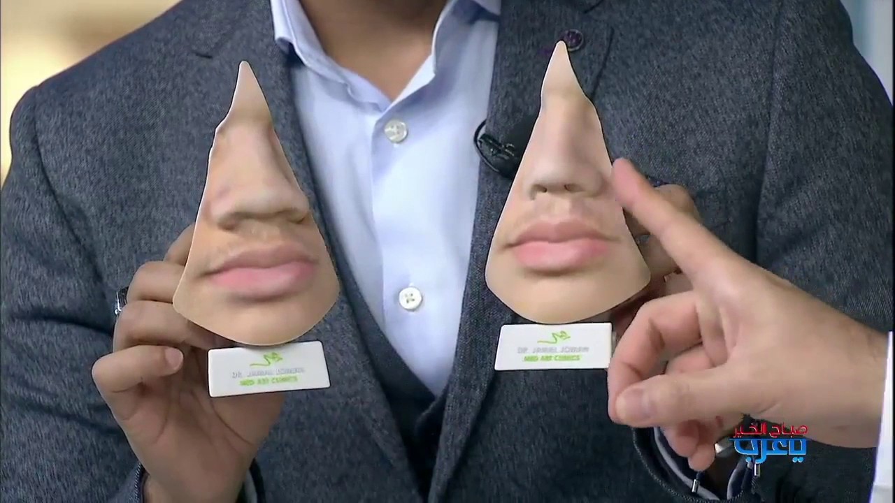 تجميل الانف ثلاثي الابعاد