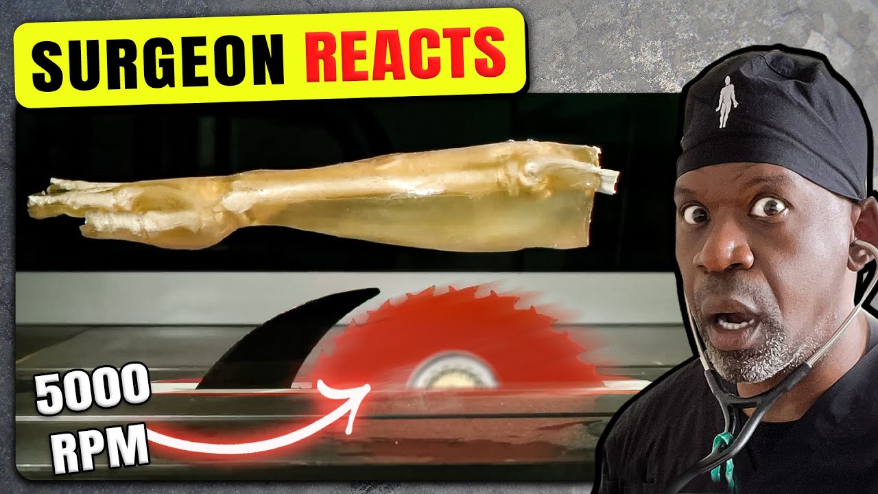 Surgeon Reacts To Woodworking Injuries&hellip;In Slow Motion | Dr Chris Raynor (Be Careful On The Job!)
