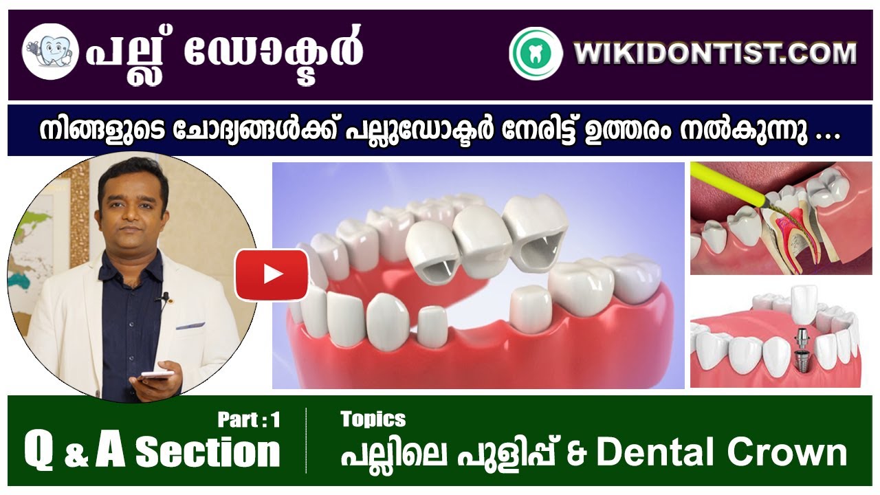 Q & A Section, Part 1, പല്ലിലെ പുളിപ്പ് & Dental crowns l Malayalam l മലയാളം