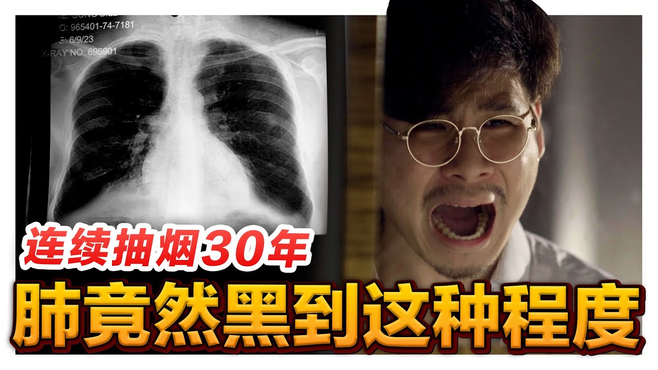 抽烟抽了30年 要怎样戒烟?? 戒烟副作用超严重 导致精神分裂… 你还敢抽烟吗?｜低清 Dissy｜搞笑日常｜