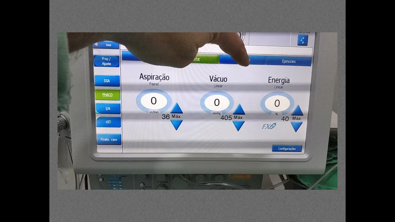 Tudo sobre o Intuitiv Compact