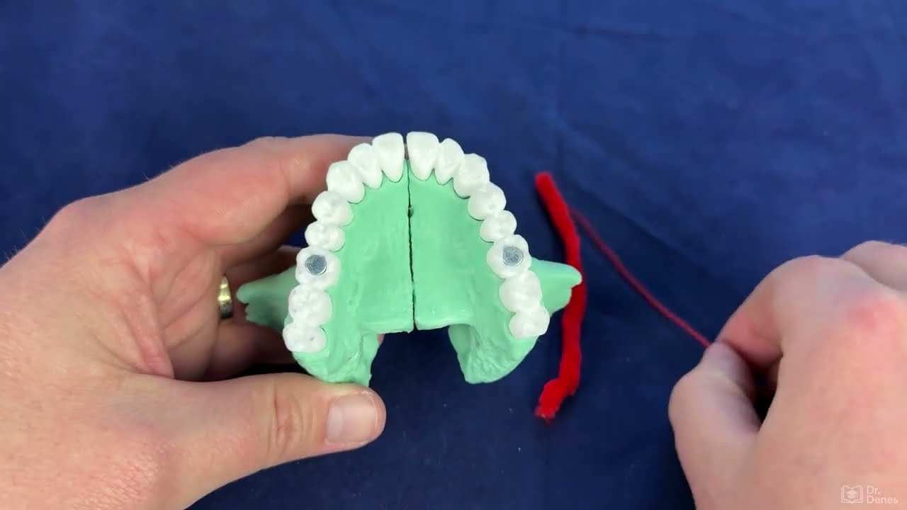 The maxilla (Maxilla)