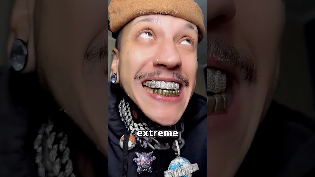 Why This Guy’s Teeth Are All Metal 