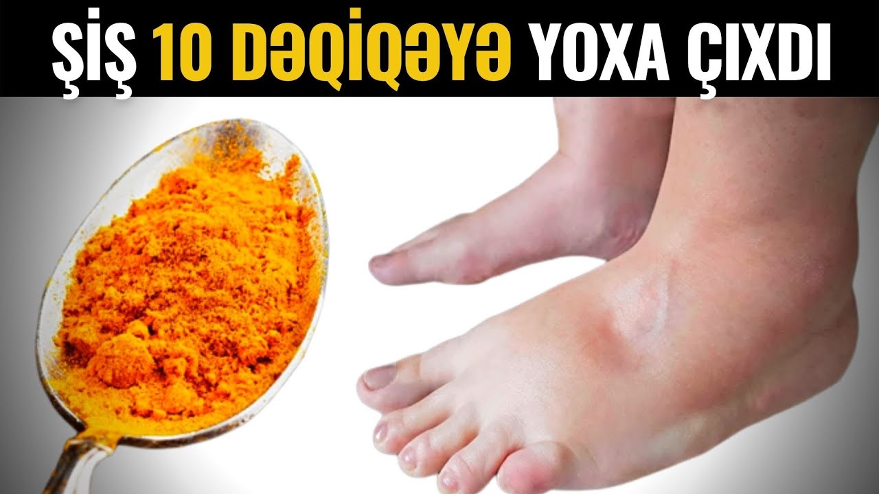 Sağaltmadığı Xəstəlik Yoxdur - K&ouml;hnə Həkimlərin SİRRİ