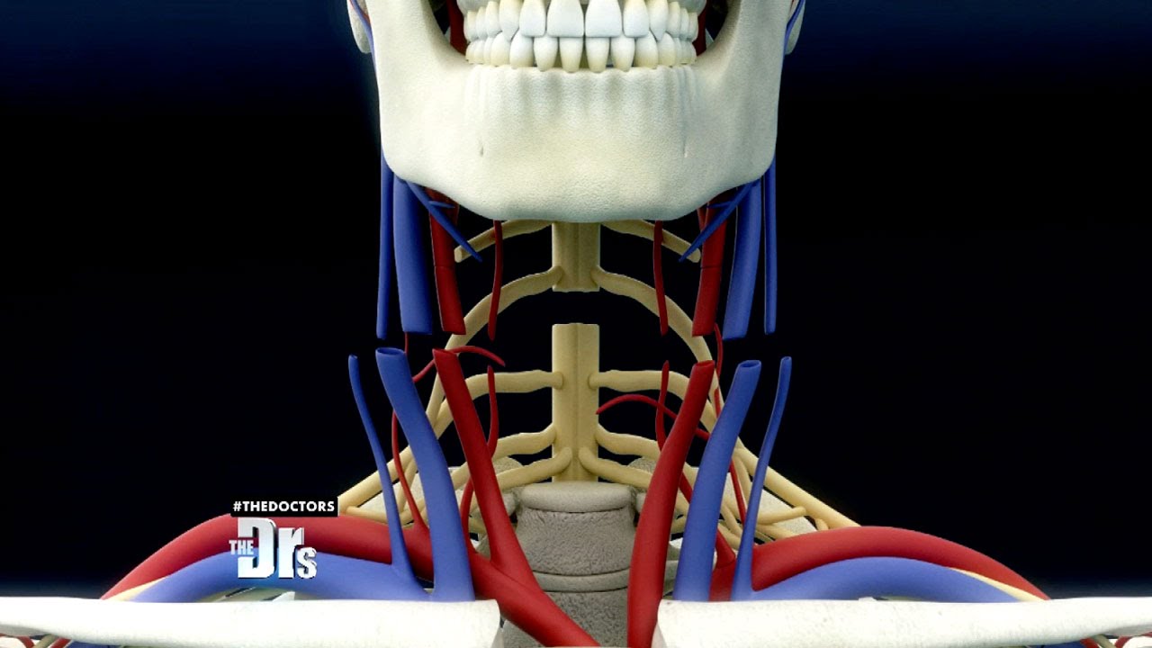 Is Head Transplant Surgery Possible?