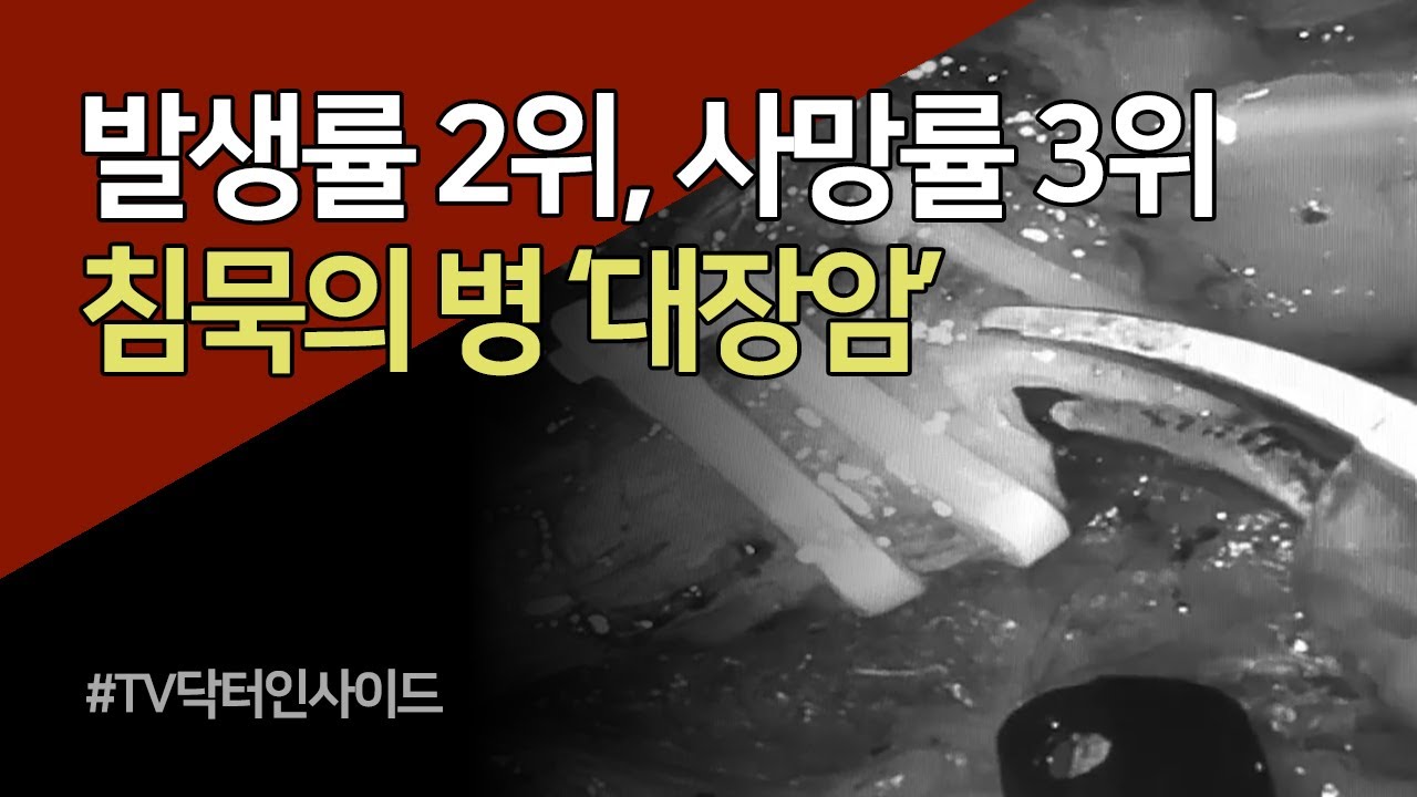 침묵의 병, 대장암 / TV닥터인사이드 부산MBC 20200120 방송