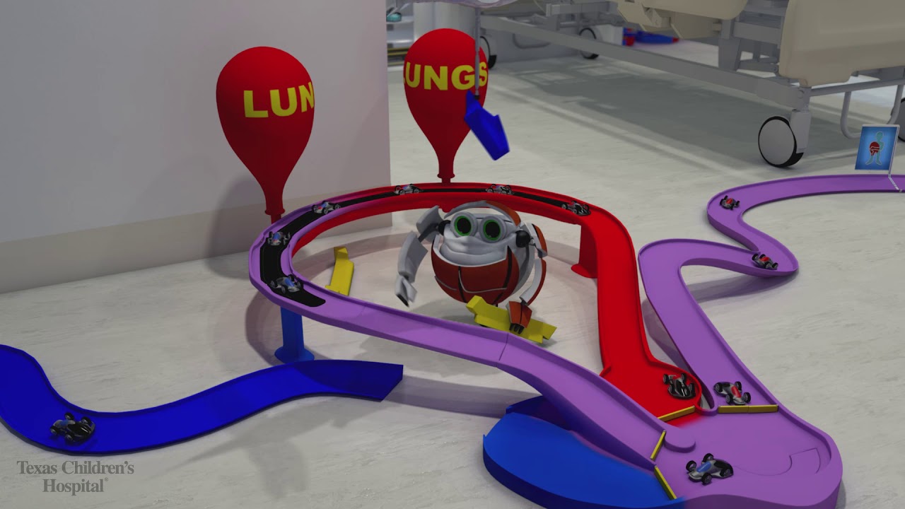 Double Inlet Ventricle: Surgery Fontan