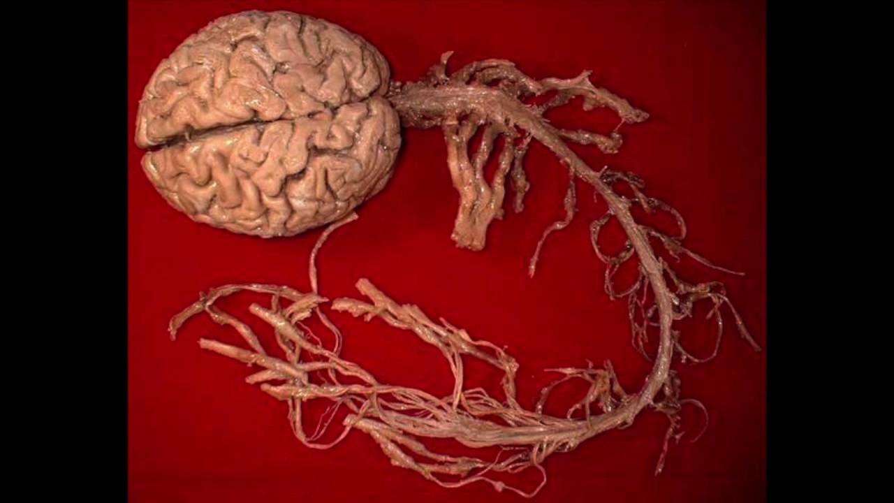 Multiple Sclerosis by Ciggy De Veyra and Alex Voisard