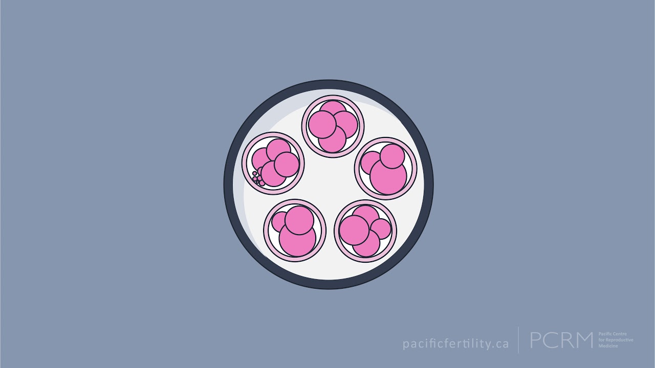What is Preimplantation Genetic Testing? - PCRM Fertility Clinic