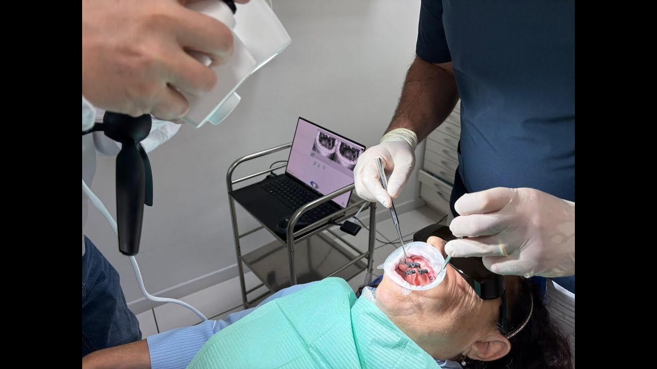 3Dots: Dental Photogrammetry Scanner | Unrivaled Implant Accuracy & IOS Scanner Complement
