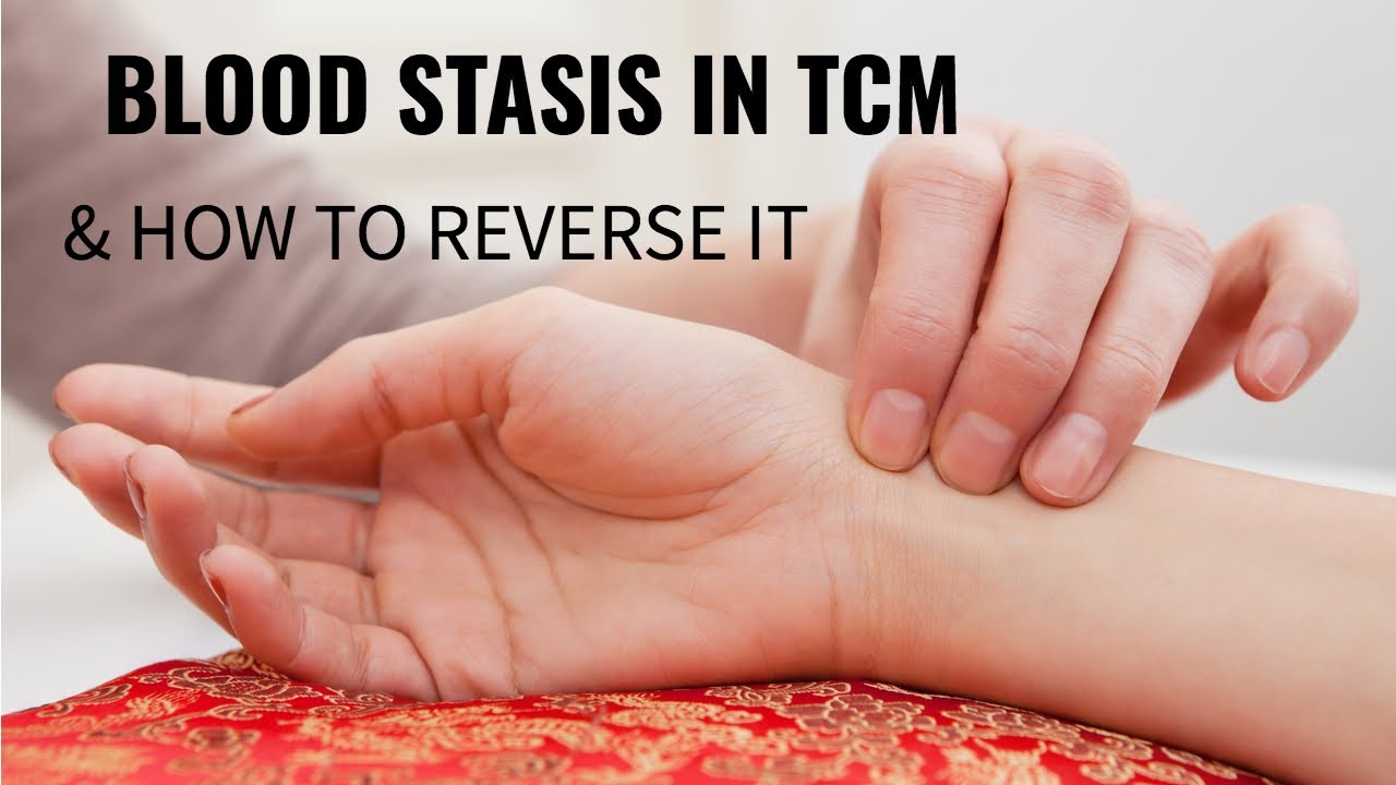 Blood Stasis in TCM and How To Reverse It