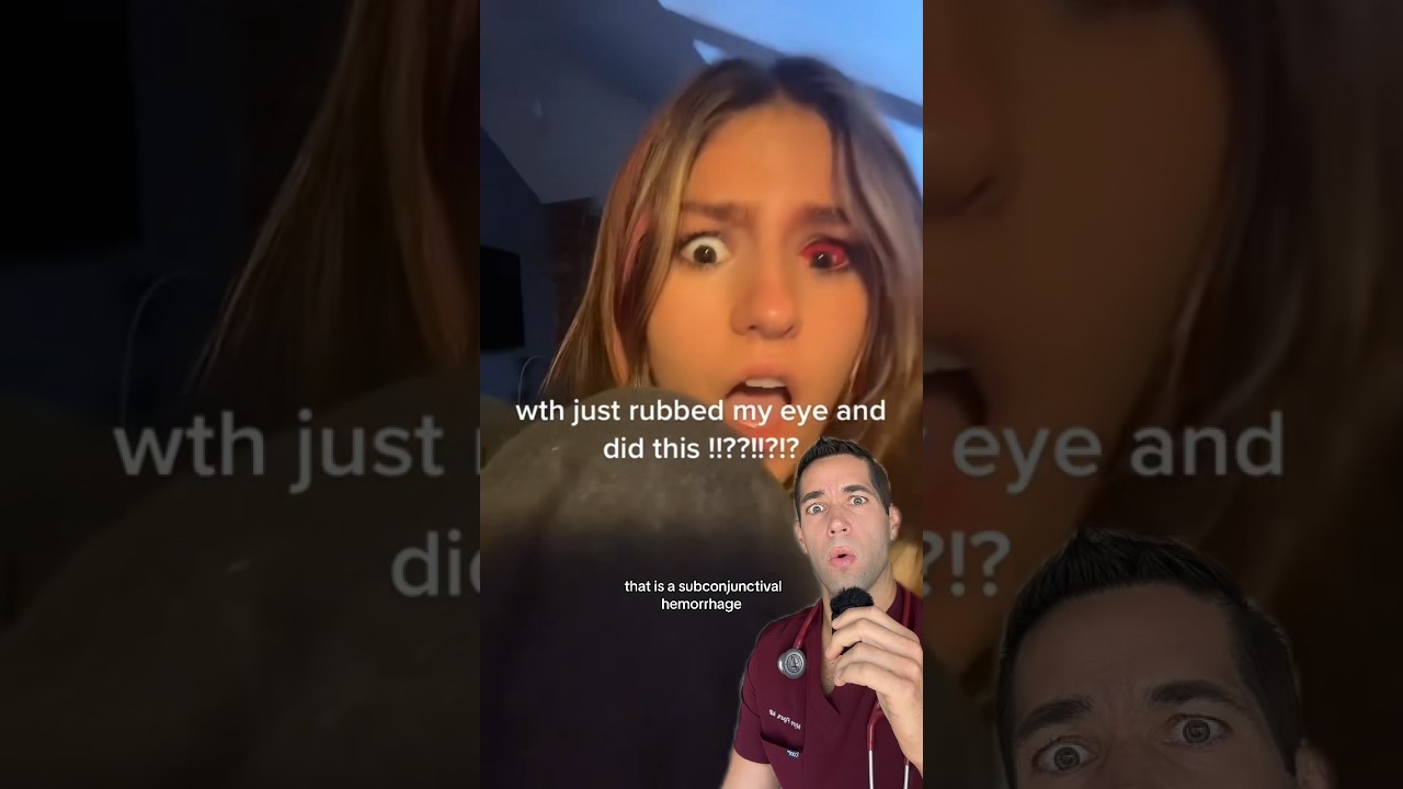 Her eye just imploded?!