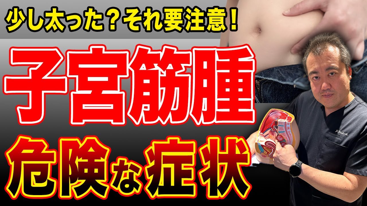 放置厳禁！！子宮筋腫を疑う体の異変とは？【教えてドクター】
