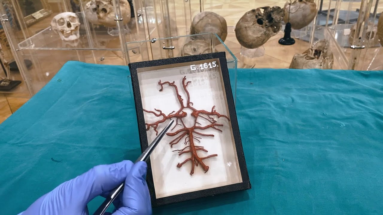 Wie kommt das Blut in den Kopf? Blutversorgung Gehirn | Sezierkurs Live Anatomie Innsbruck