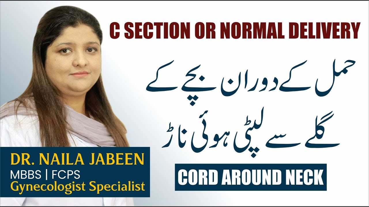 Delivery With Cord Around Neck | Umbilical Cord | Nuchal Cord Delivery in Urdu | Placenta in Neck