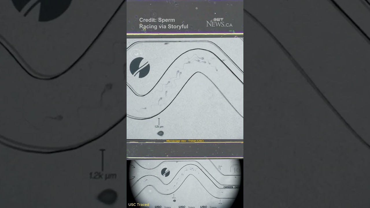 First sperm races held on 'World’s smallest racetrack'