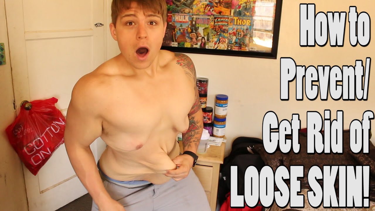 Loose Skin: The FACTS