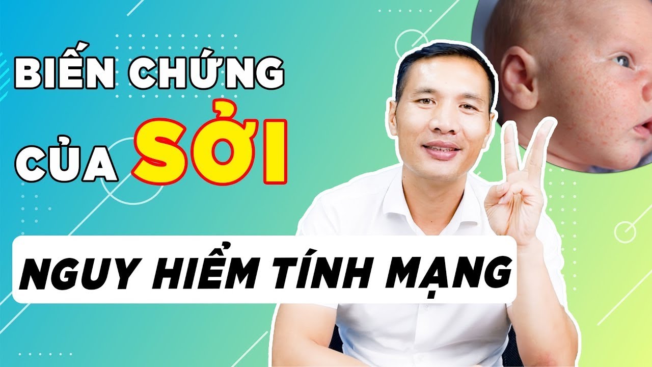Dấu hiệu nhận bệnh sởi ở trẻ em cách điều trị NGAY TẠI NHÀ | DS Trương Minh Đạt