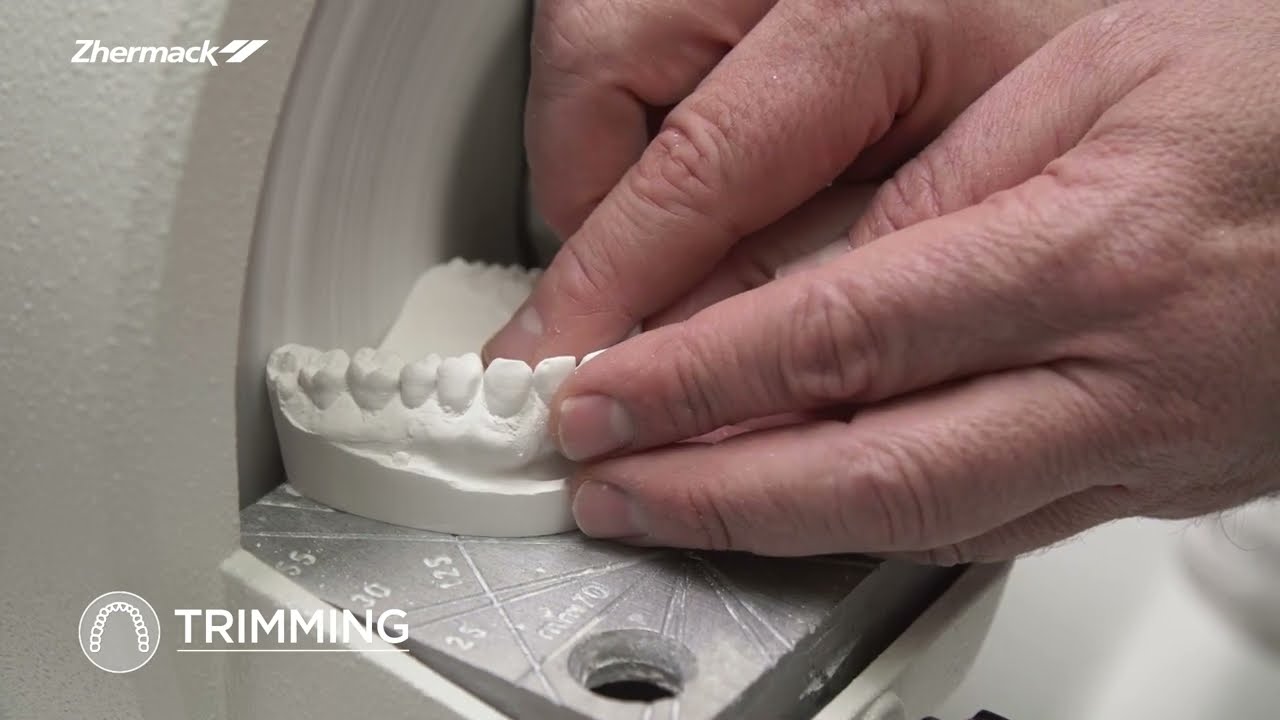 Dental Lab Procedure for Provisional Crown Restoration - Chap. 5: Master Model