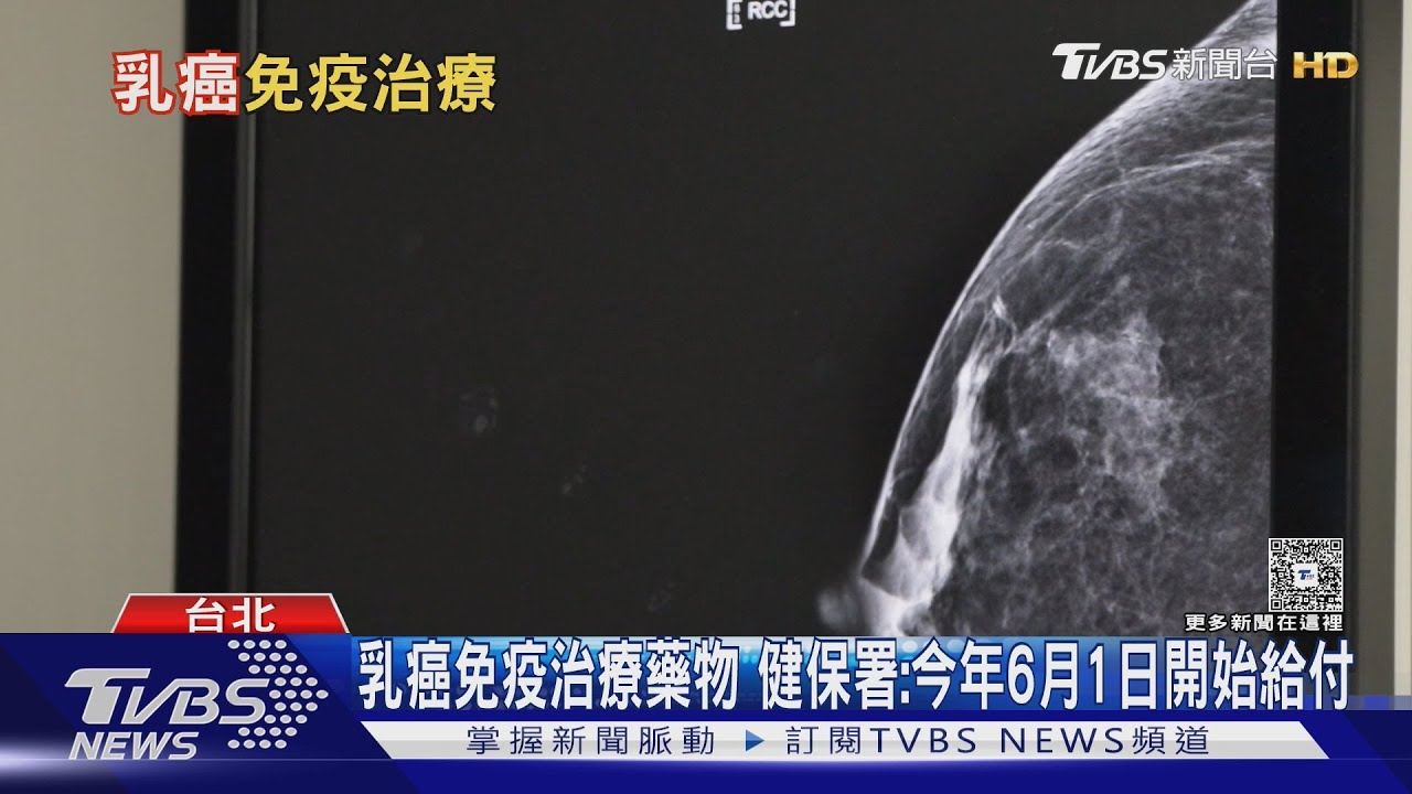 出現「這幾種」狀況  罹乳癌機率增 醫師警告:年輕化趨勢  不可忽視!｜十點不一樣20250422 