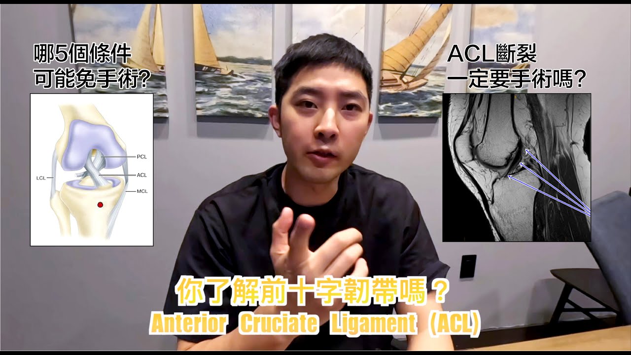 ACL斷裂一定要開刀？『上集』 2025最新研究與保守治療全解析！免手術的「5大條件」復健回歸運動！
