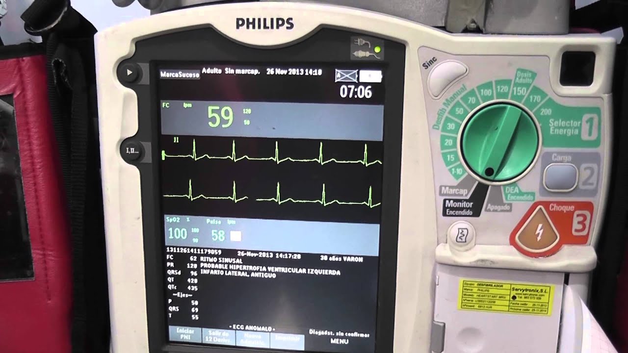 Philips ECG Management Systems - Telemedicine in the Baleares