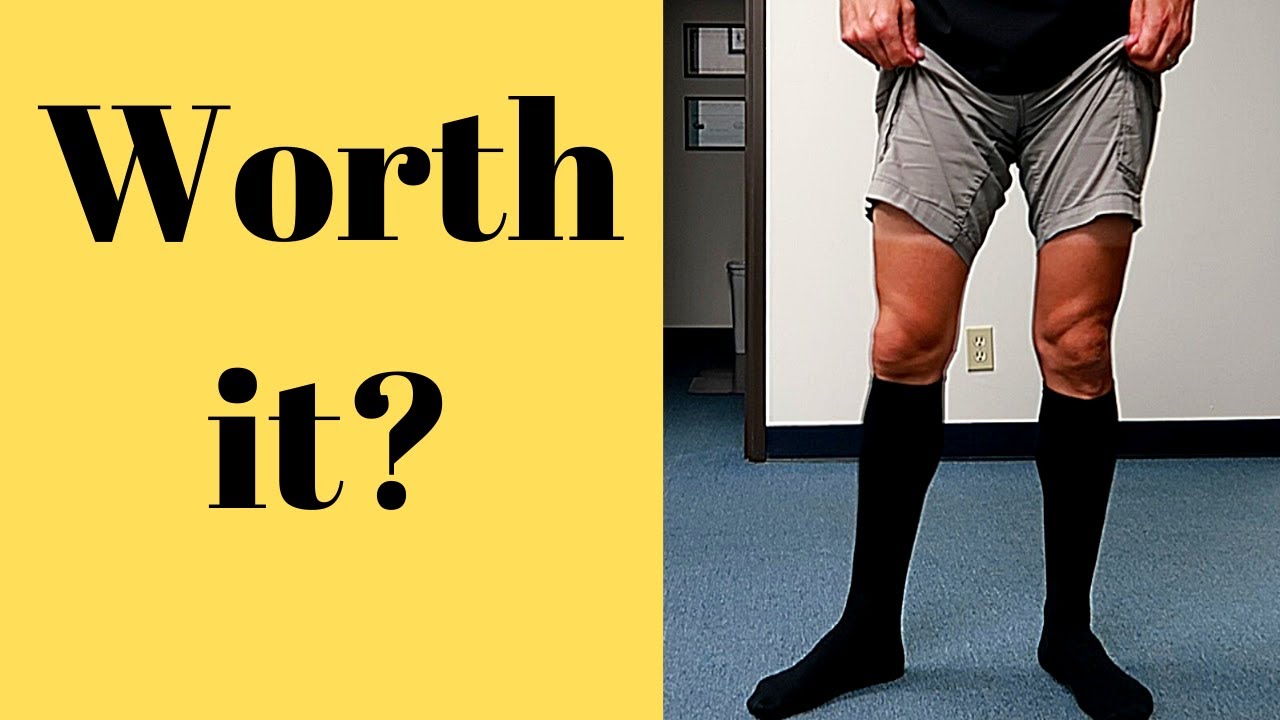 Compression Socks: Should you use them? 🤷‍♀️👈