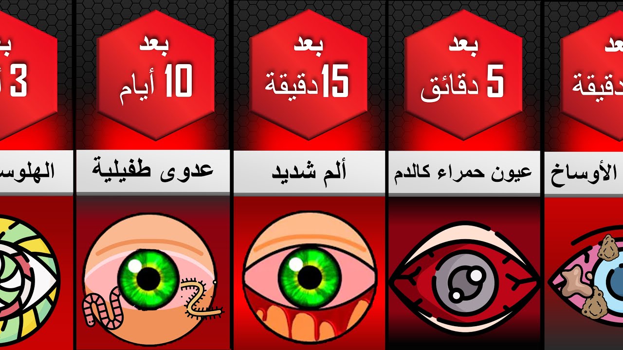 ماذا سيحدث لك إن توقفت عن رمش عينيك لا تجرب هذا في المنزل