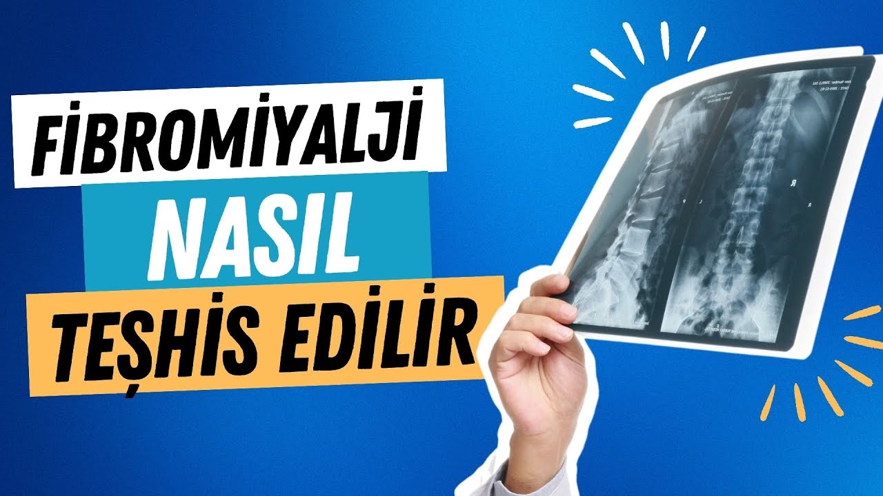 Fibromiyalji Nasıl Teşhis Edilir 🌿