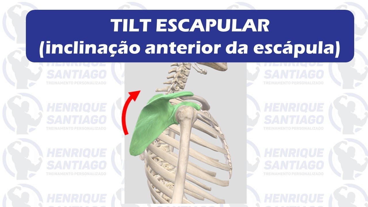 TILT Escapular